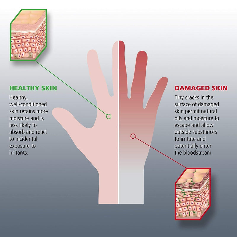 GOJO® HAND MEDIC 8150 148ml Professional Skin Conditioner Barrier Cream